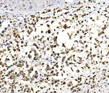 JUNB Antibody