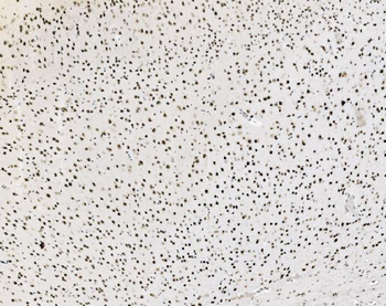 JUNB Antibody