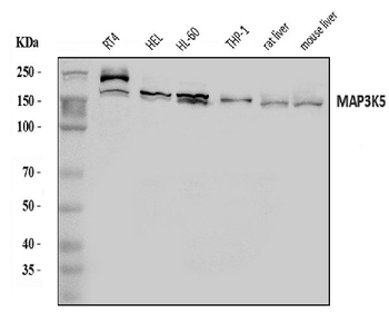 ASK1/MAP3K5 Antibody