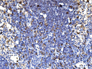 PAK1 Antibody