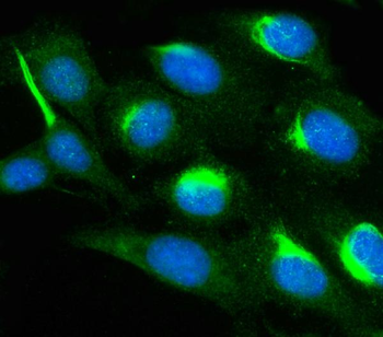 PAK1 Antibody