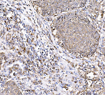 PAK1 Antibody