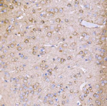 PAK1 Antibody