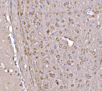PAK1 Antibody