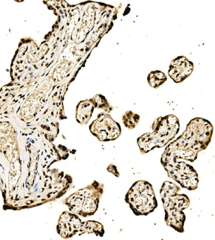 SPHK1 Antibody