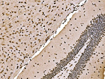 SPHK1 Antibody