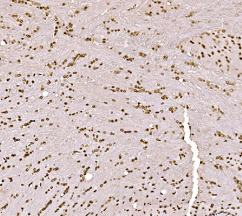 SPHK1 Antibody