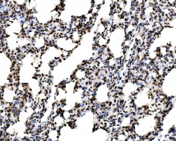 SPHK1 Antibody