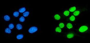 SPHK1 Antibody