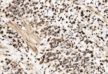 SPHK1 Antibody