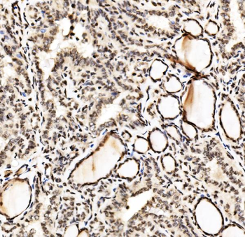 SPHK1 Antibody