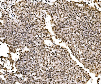 SPHK1 Antibody