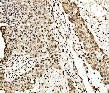 SPHK1 Antibody