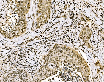 SPHK1 Antibody