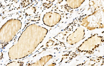 SPHK1 Antibody