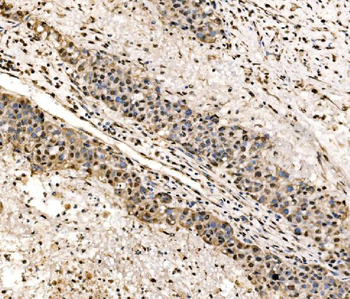 SSB Rabbit Polyclonal Antibody