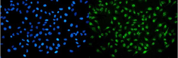 NIRF Mouse Monoclonal Antibody