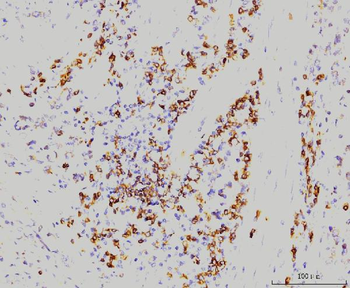 Rab11A Antibody (monoclonal, 4H9)