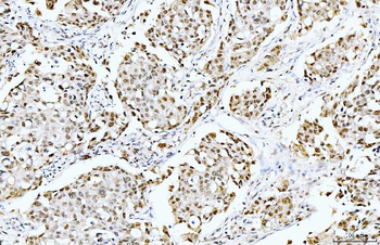 Cyclophilin E/PPIE Antibody (monoclonal, 4I9)