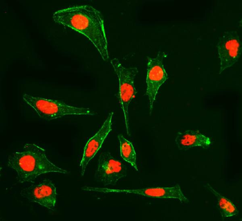 Cyclophilin E/PPIE Antibody (monoclonal, 7F2)