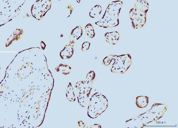 Cyclophilin E/PPIE Antibody (monoclonal, 7F2)