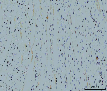Cyclophilin E/PPIE Antibody (monoclonal, 7F2)