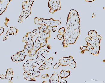 LSM8 Antibody (monoclonal, 6B11)