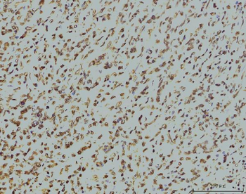 RPA32/RPA2 Antibody (monoclonal, 3B2E9)