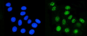 DHODH Mouse Monoclonal Antibody