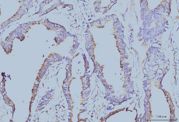 EIF4A1 Antibody (monoclonal, 3F11)