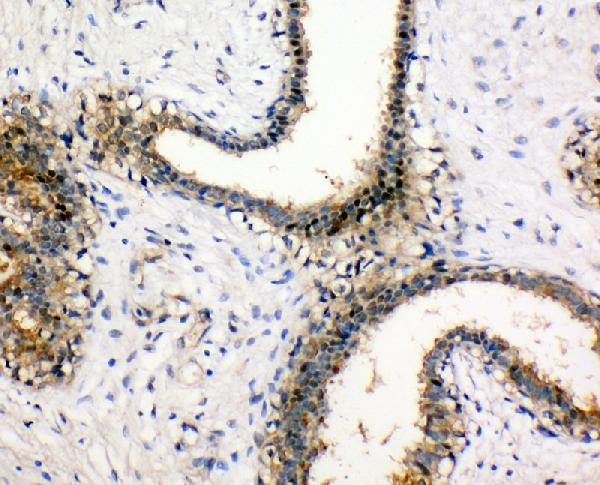 NM23A/NME1 Rabbit Polyclonal Antibody