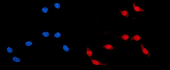 ADRM1/ARM-1 Antibody