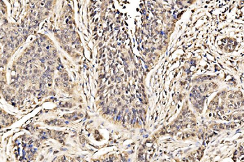 ADRM1/ARM-1 Antibody