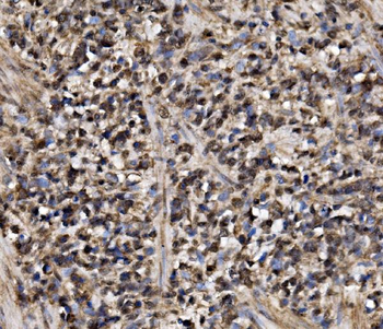 ADRM1/ARM-1 Antibody