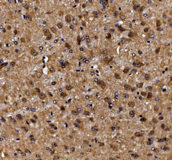 ADRM1/ARM-1 Antibody