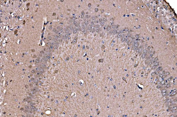 ADRM1/ARM-1 Antibody