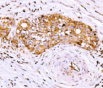 AGPAT2 Rabbit Polyclonal Antibody
