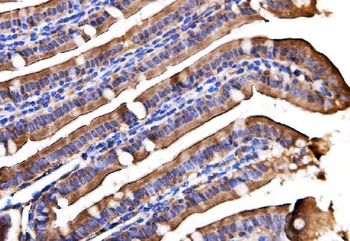 AGPAT2 Rabbit Polyclonal Antibody