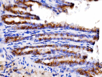 AGPAT2 Rabbit Polyclonal Antibody