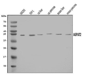 AGPAT2 Rabbit Polyclonal Antibody