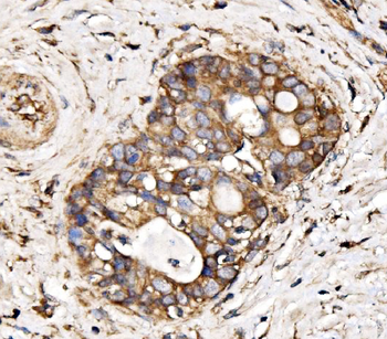 IRBIT/AHCYL1 Antibody