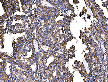 IRBIT/AHCYL1 Antibody