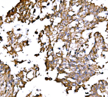 IRBIT/AHCYL1 Antibody