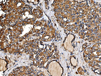 IRBIT/AHCYL1 Antibody