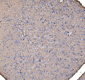 IRBIT/AHCYL1 Antibody