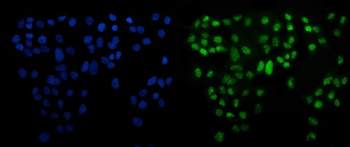 ATF6 Rabbit Polyclonal Antibody