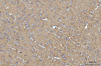 ATP1B1 Antibody