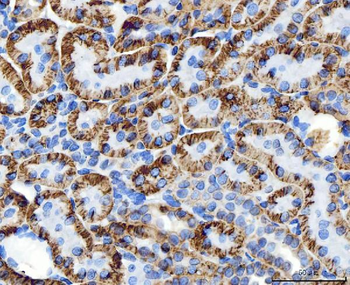ATP1B1 Antibody
