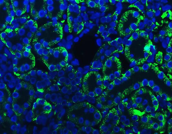 ATP1B1 Antibody