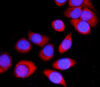 ATP1B1 Antibody